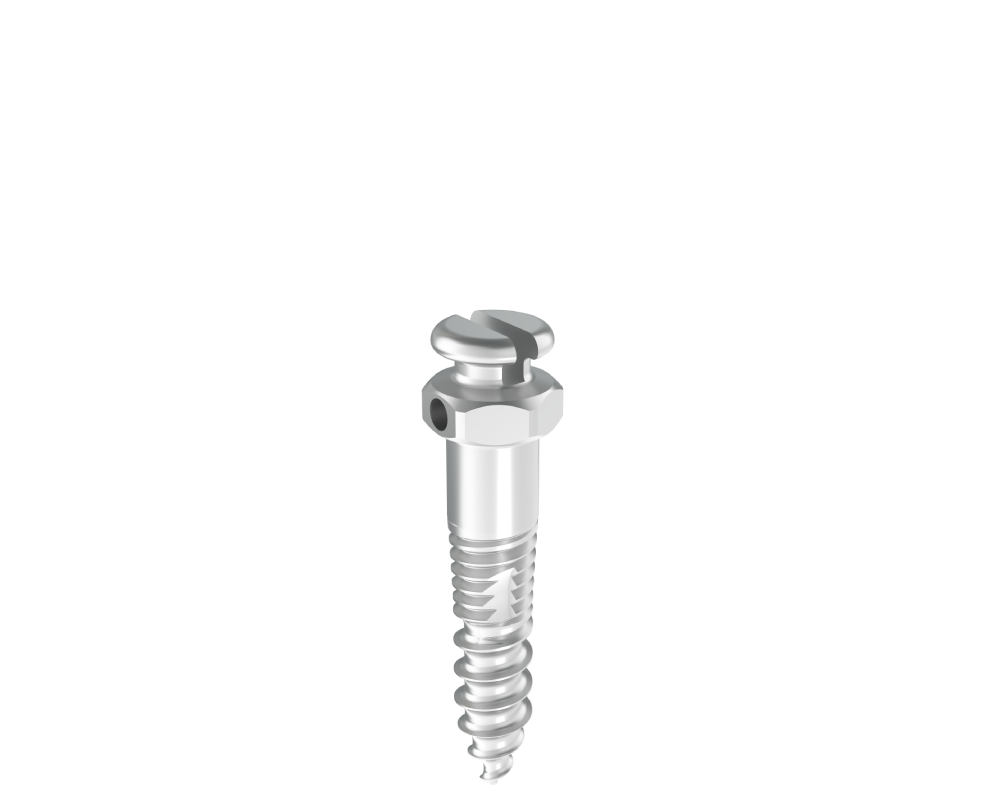 Mini-implante Interradicular HS Bracket