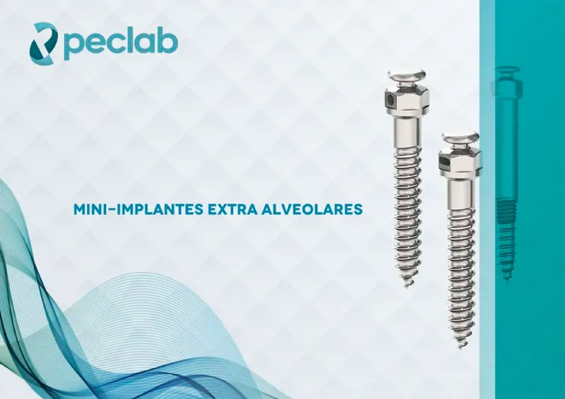 extra-alveolares.pdf
