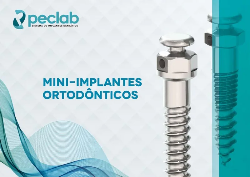 mini-implantes.pdf